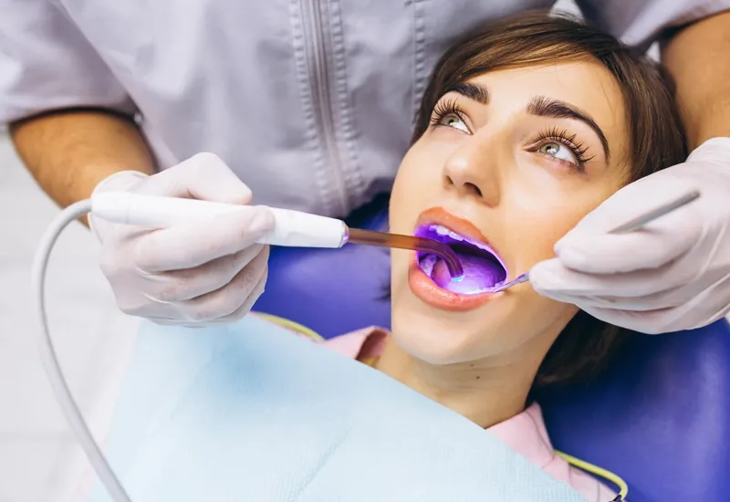 Are You at High Risk for Cavities? Let Your Dentist Recommend the Right Fluoride Treatment