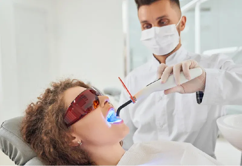 Teeth Whitening vs Veneer Which Option Fit Your Goal